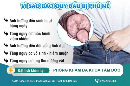 Bao quy đầu bị phù nề: Dấu hiệu của bệnh lý gì? Cách chữa trị hiện nay