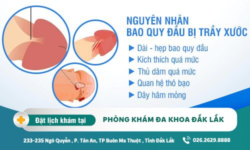 Hiện tượng trầy xước bao quy đầu là bệnh gì? Cách khắc phục bệnh lý