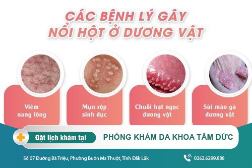 Nổi nốt đỏ ở dương vật - triệu chứng của bệnh lý dương vật