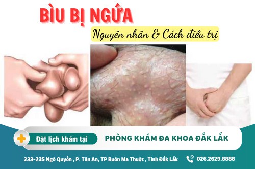 Triệu chứng bìu bị ngứa: nguyên nhân - bệnh lý - cách điều trị