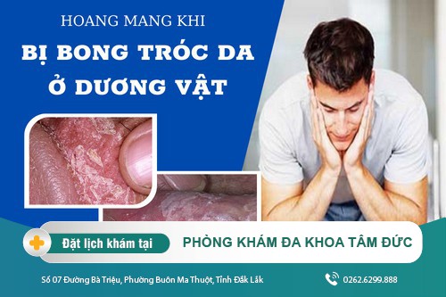 Nguyên nhân dương vật bị tróc da và giải pháp điều trị