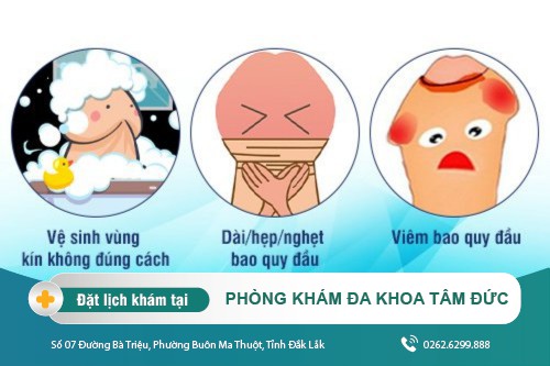 Bựa sinh dục những điều ở nam giới ít ai biết