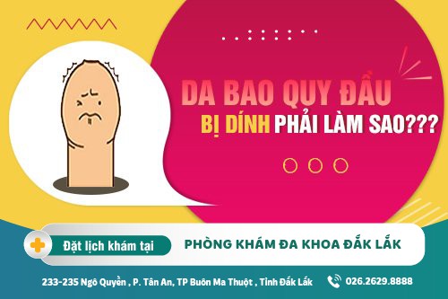 Dính bao quy đầu ở phái mạnh nguyên nhân và cách khắc phục ra sao