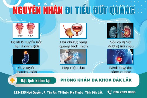 Đi tiểu đứt quãng là bệnh gì? nguyên nhân và cách điều trị hiệu quả