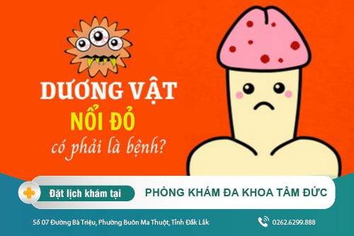 Triệu chứng đầu dương vật bị đỏ báo hiệu điều gì?