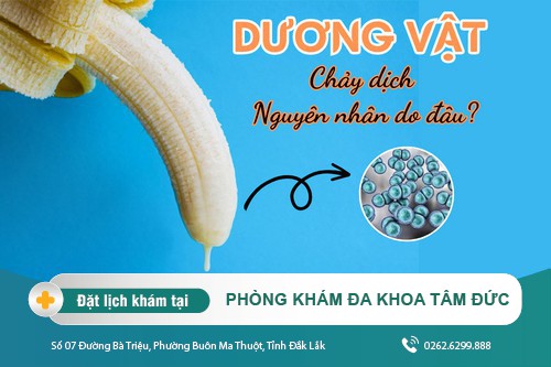 Dương vật chảy dịch là tại sao - cách điều trị hiệu quả