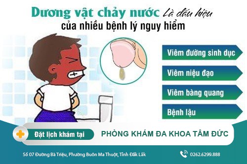 Dương vật chảy nước - Biểu hiện bệnh lý nguy hiểm