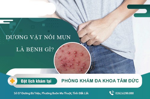 Cậu nhỏ nổi mụn nguyên nhân do đâu?