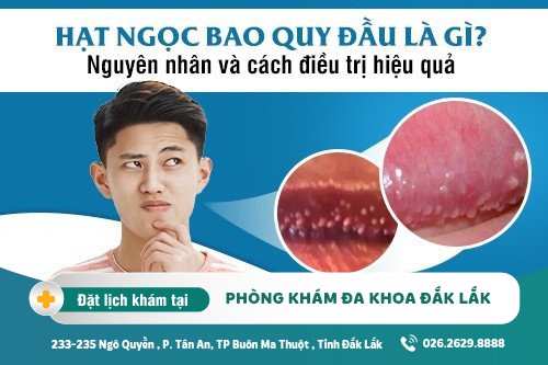 Tổng hợp những điều bạn nên biết về hạt ngọc bao quy đầu