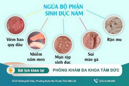 Các nguyên nhân ngứa bộ phận sinh dục và cách điều trị tại Đa Khoa Tâm Đức