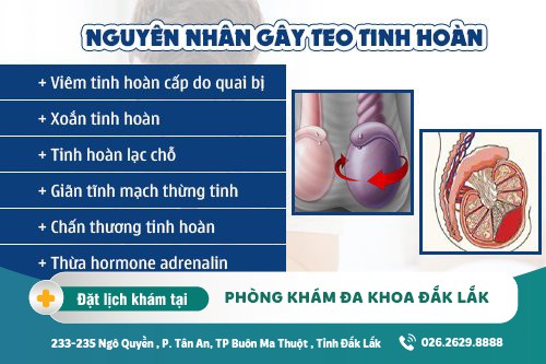 Teo tinh hoàn - bệnh lý nguy hiểm ở nam giới , tham khảo ngay phương pháp điều trị hiện nay