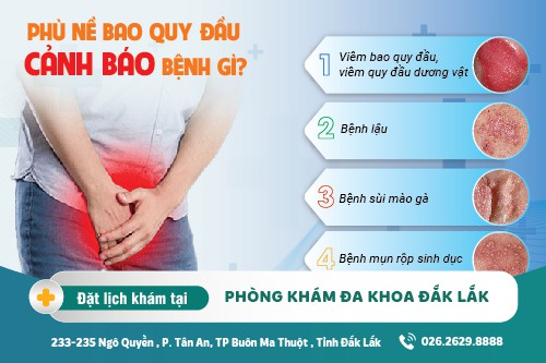 Phù nề bao quy đầu: Dấu hiệu của bệnh gì? Cách điều trị hiệu quả hiện nay