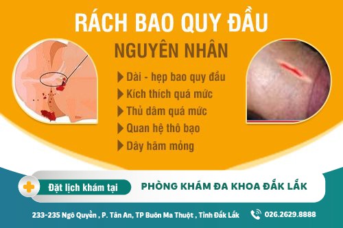 Rách bao quy đầu phải làm sao? Khắc phục bao quy đầu bị rách