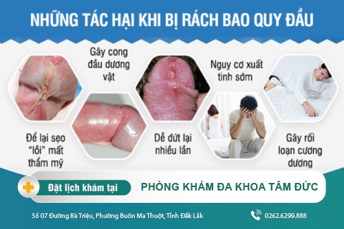 Điều trị rách bao quy đầu hiệu quả tại Phòng Khám Nam Khoa Tâm Đức