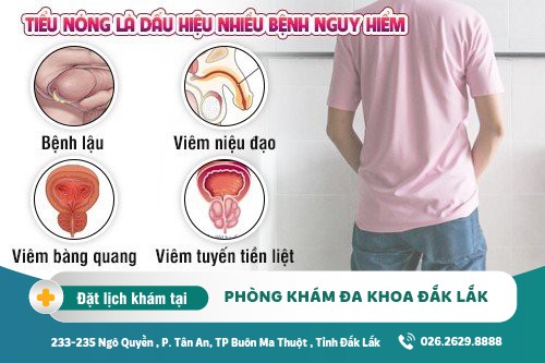 Tiểu nóng dấu hiệu bệnh gì? Cần làm gì khi tiểu nóng