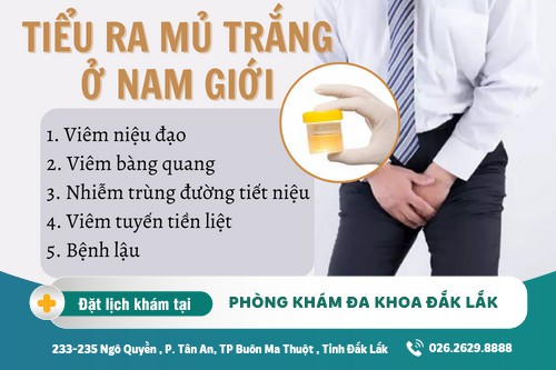 Chú ý tình trạng nguy hiểm khi đi tiểu có mủ trắng