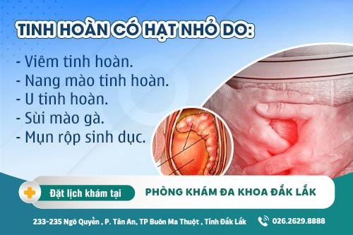 Tinh hoàn nổi hạt ở nam giới là dấu hiệu của bệnh lý gì? có gây nguy hiểm?